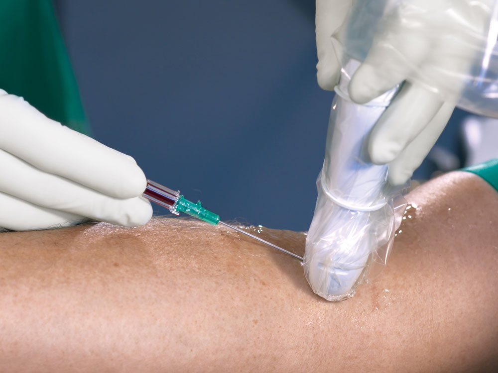 Hand in white glove holds green cannula on arm with transparent gel. Other hand in white glove holds ultrasound probe with transparent protective cover fixed with white rubber ring.